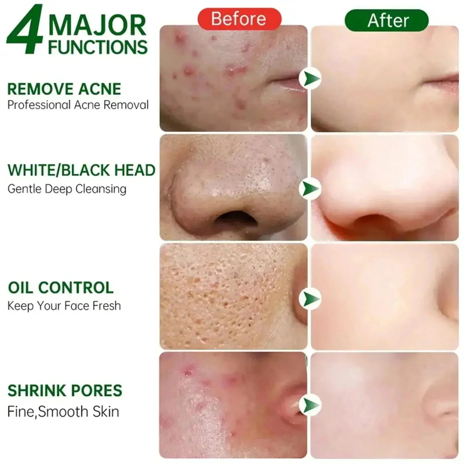 Salicylic Acid Pore Clearing C - Korean Skincare Routine review and price