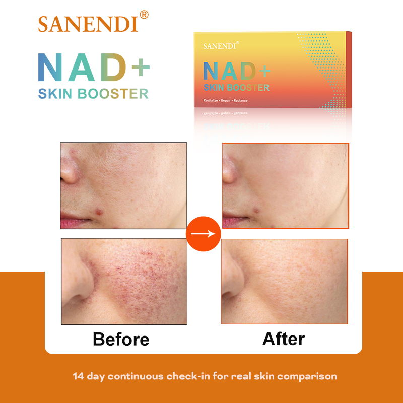 Sanendi NAD+ Korea Skincare Pr - Korean Skincare Routine review and price
